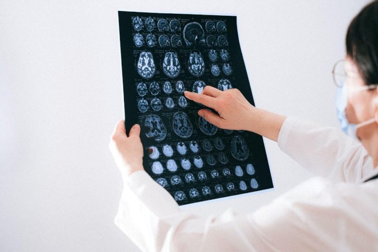 Three Tips To Find A Great Neurosurgeon